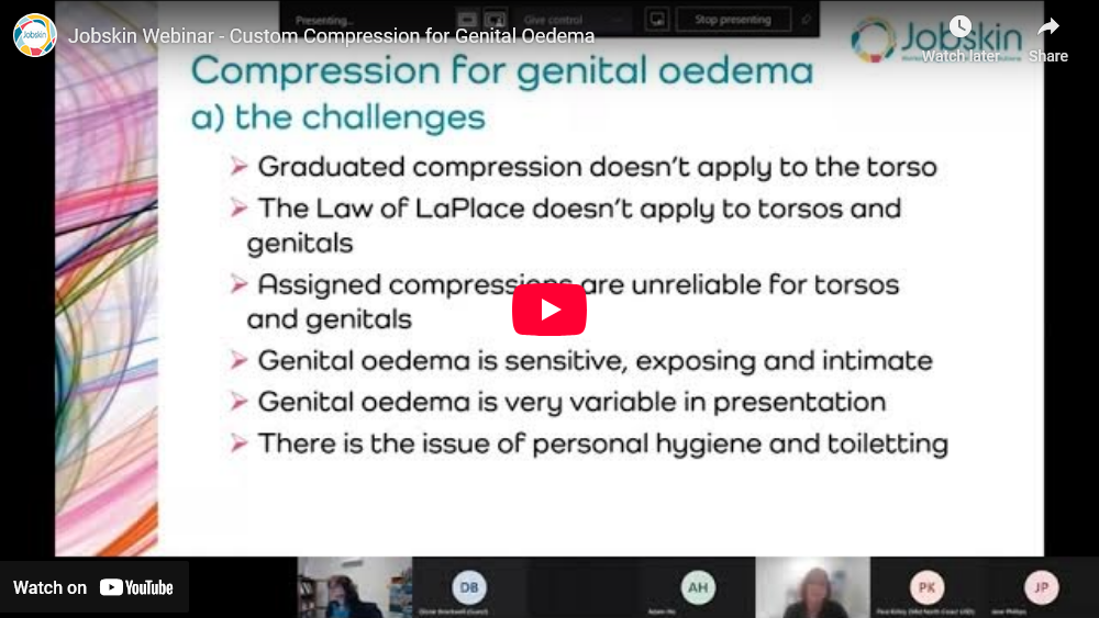 Custom Compression for Genital Oedema